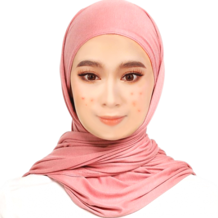 KULIT BERJERAWAT